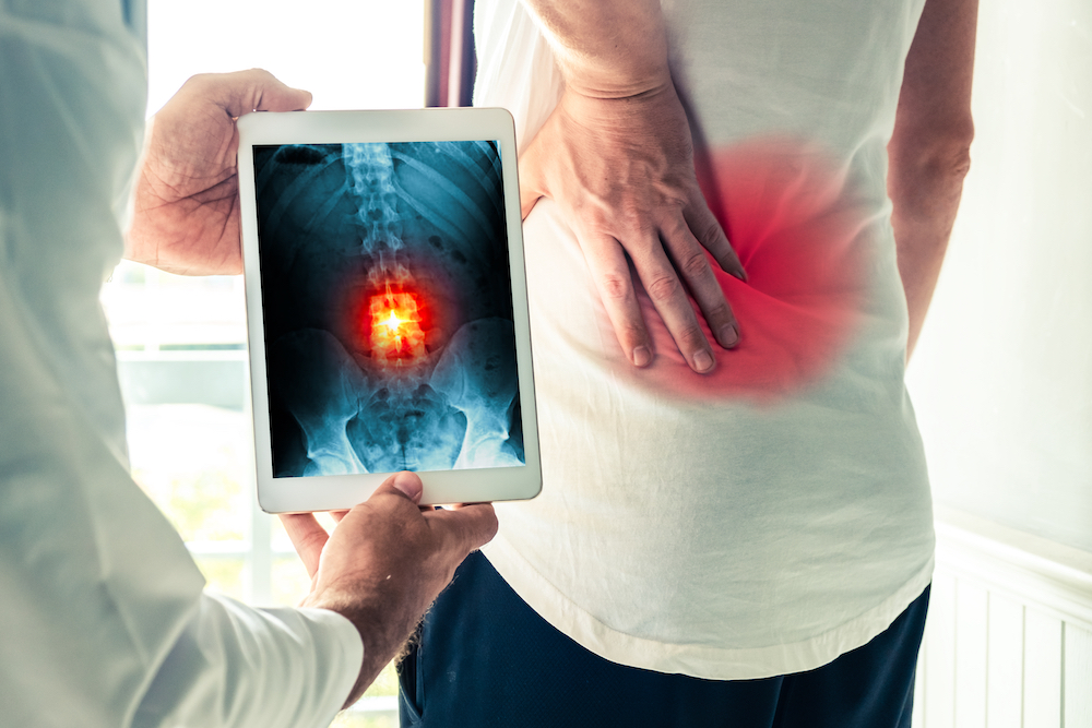 dr showing patient her spine x-ray result in a tablet